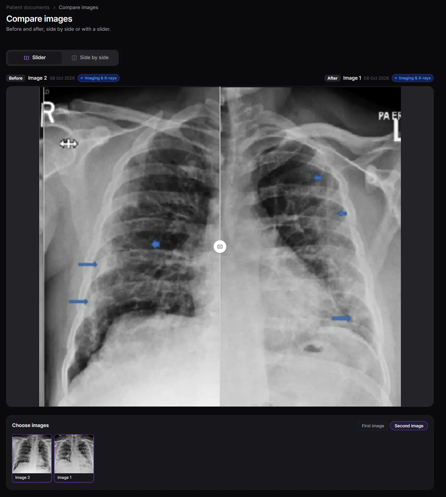 Before and after image comparison