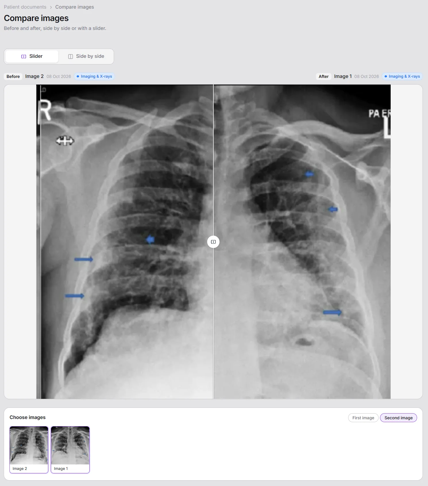Before and after image comparison